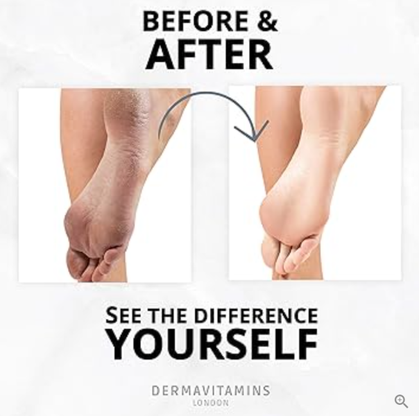 Dermavitamins| Zaawansowana maska do stóp - regeneruje suche stopy (zabieg peelingujący)